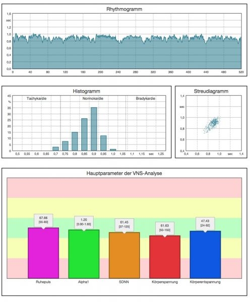 VNS ANALYSE PROFESSIONAL Plus